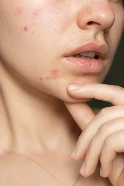 Combination Skin - LushBloom