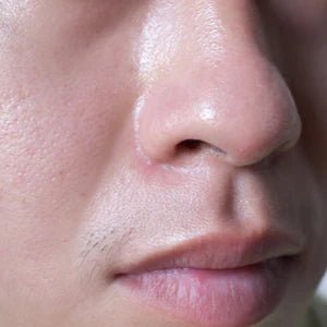 Oily Skin - LushBloom